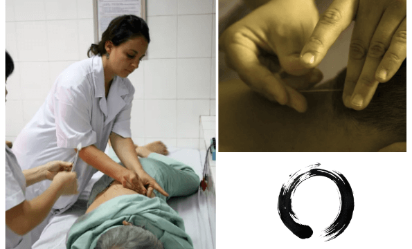 ACUPUNCTURE LAUSANNE & PULLY | 1 séance offerte