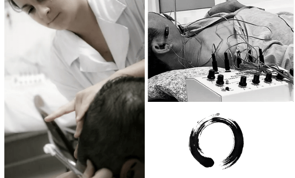 ACUPUNCTURE LAUSANNE & PULLY | 1 séance offerte